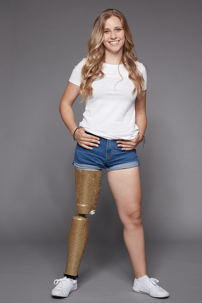 Desiree Vila, la atleta paralímpica posa con su pierna de brilli brilli